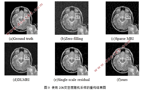 基于深度残差扩张网络的磁共振图像重构